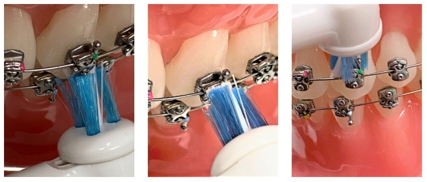 brushing-1