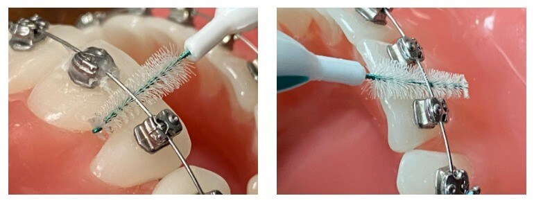 brushing-2