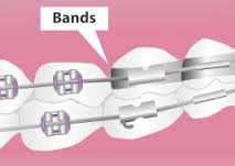 Bands