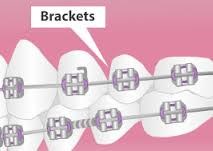 Brackets