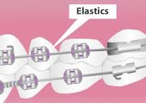 Elastics