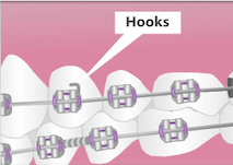 Hooks