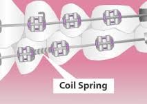 Coil Spring