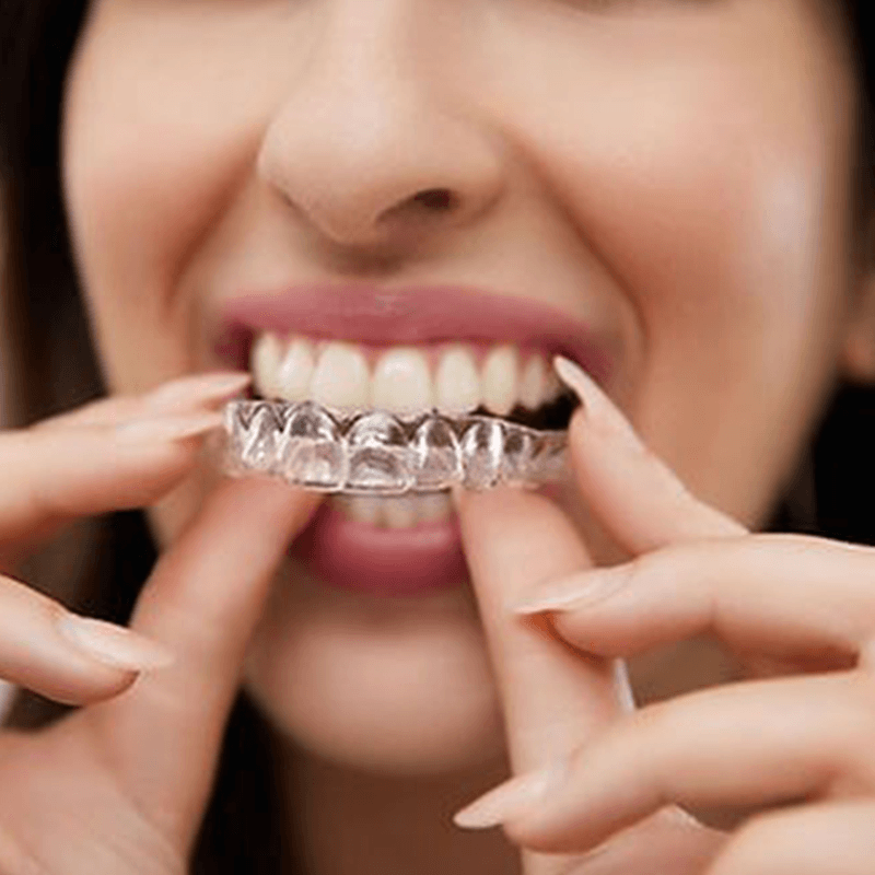 Retainer Club